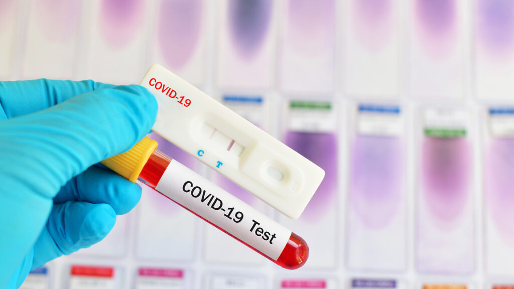 Глава Килийской ОТГ: результаты тестов на COVID-19 приходят с большим опозданием, и это создает угрозу для пациентов