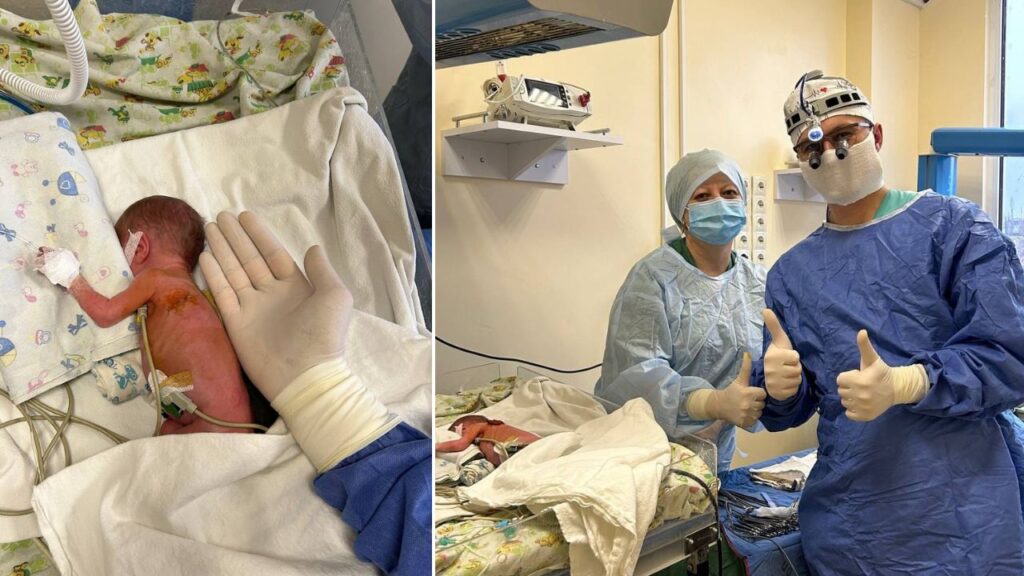 Одеські хірурги прооперували дитину, яка не важить й кілограма (Фото)