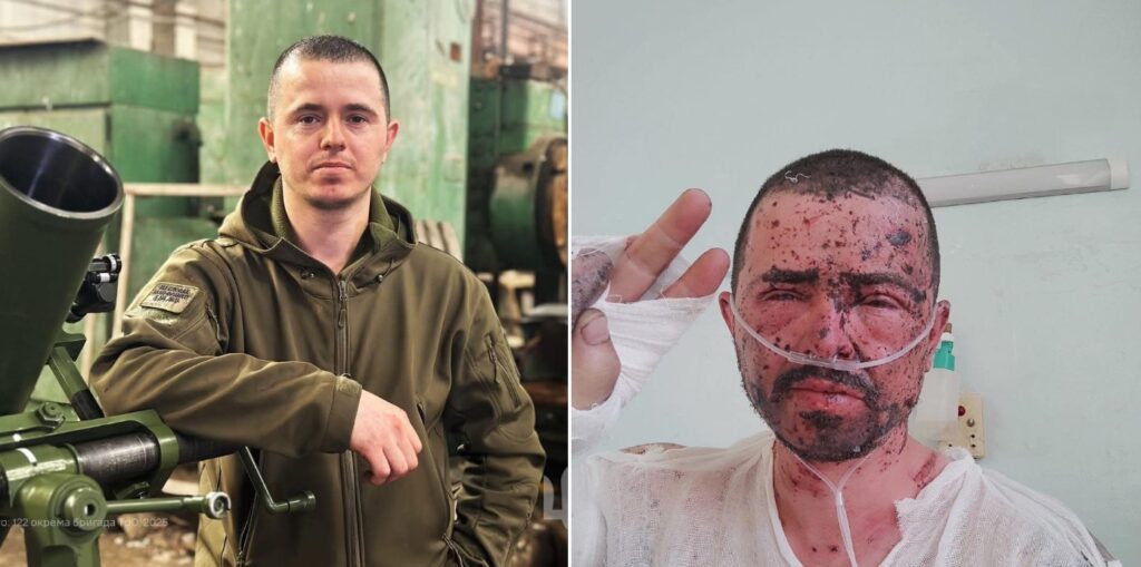 Військовослужбовець з Болградської громади з позивним Гаджал зазнав поранень обличчя